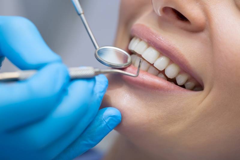 Remplacer une dent absente ou cassée grâce à un implant dentaire à Marseille