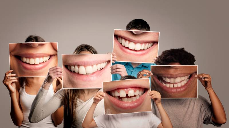 Alignement des dents de devant – Corriger un sourire désaligné sans bagues visibles à Marseille