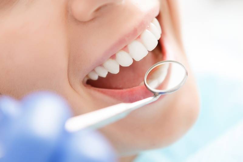 Couronnes dentaires en céramique ou zircone – Restaurer une ou plusieurs dents abîmée avec esthétique à Marseille