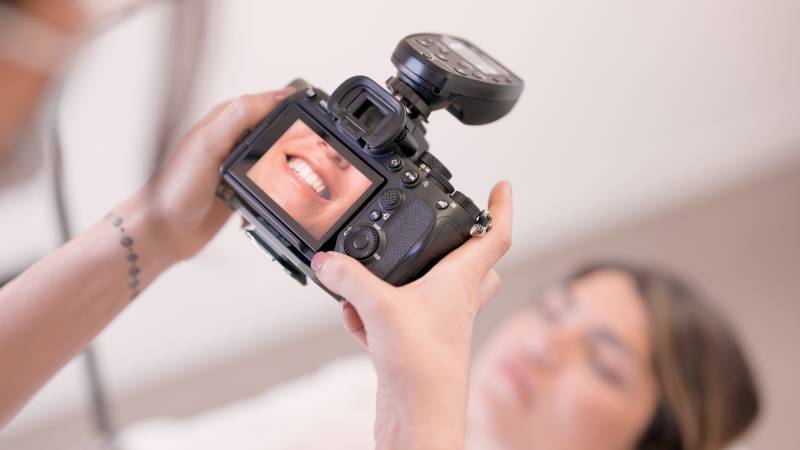 prise de photo d'un sourire avant de réaliser un blanchiment