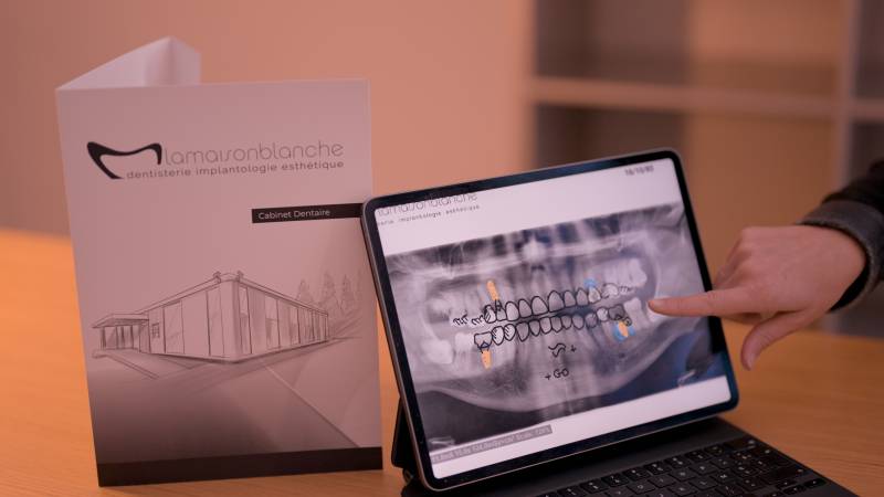 Radio panoramique dentaire servant à établir un diagnostic