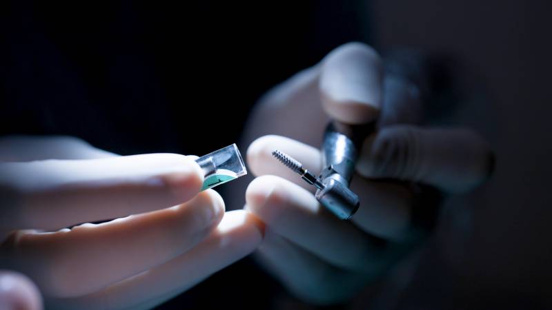 l'implant dentaire entre les mains du chirurgien-dentiste
